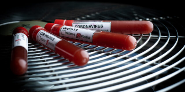 Epruvete s uzorcima krvi – testiranje na koronavirus